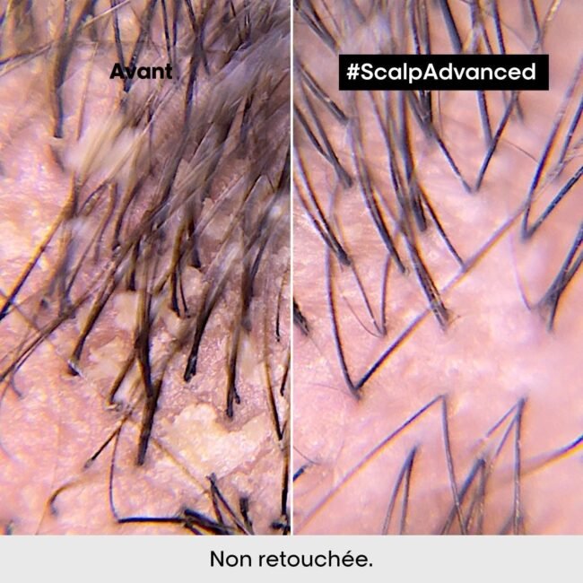 SCALPADVANCEDSHAMPOOINGPROFESSIONNELANTI-PELLICULAIRE_3.jpg