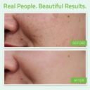 YEOUTH_Hyaluronic_Acid_Plus_2-1.jpg