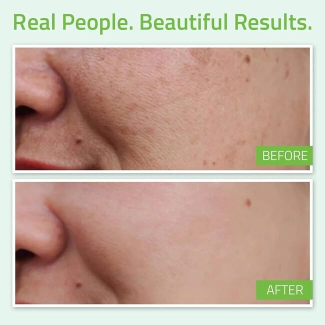YEOUTH_Hyaluronic_Acid_Plus_2-1.jpg YEOUTH_Hyaluronic_Acid_Plus_2-1.jpg