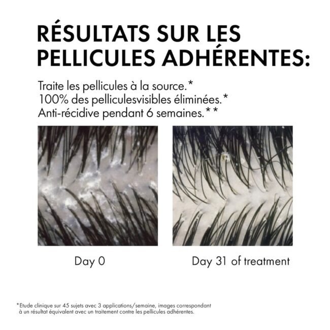 BeforeAfter-1-1.jpg