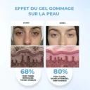 avantetapresgelgomm.webp